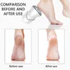 USB Rechargeable Portable Vacuum Adsorption Foot Grinder Electric Foot File Pedicure Tools Dead Skin Callus Remover Feet Sander 3