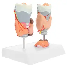 

Thyroid Pathology Model Teaching Model Anatomy Model Endocrine System Model