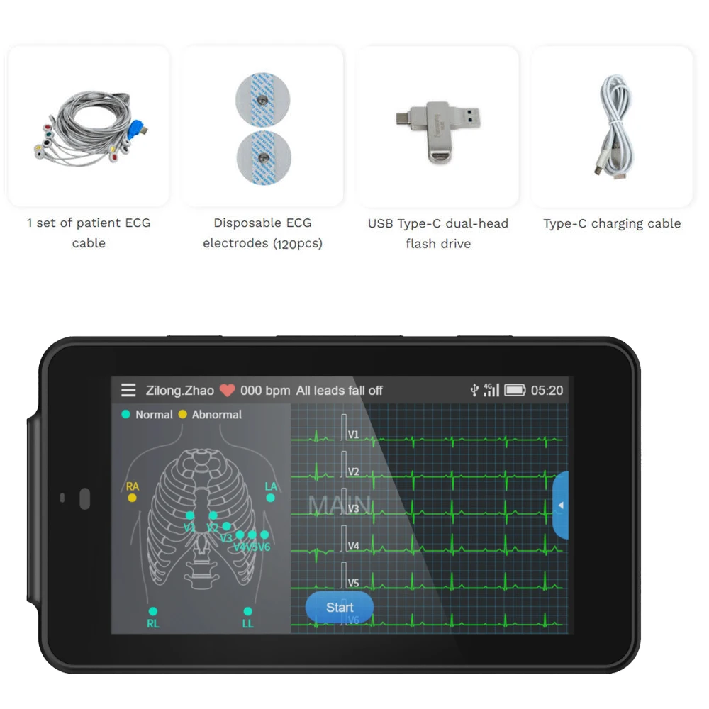 WIFI Portable ECG Machine Handheld Pocket ECG Machine Chargeable 6/12-Lead Glasgow Data Analysis Transfer 250g