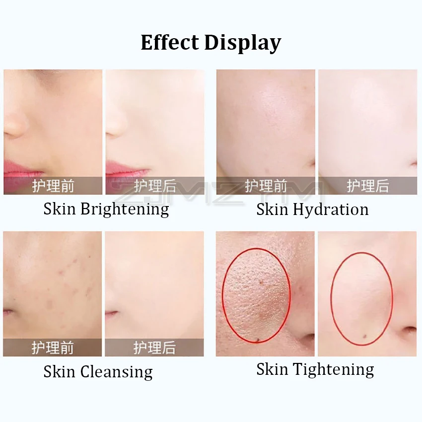 New RF Skin Lifting Machine Facial Skin Rejuvenation Wrinkle Removal SkinTightening Care Machine Facial Massager