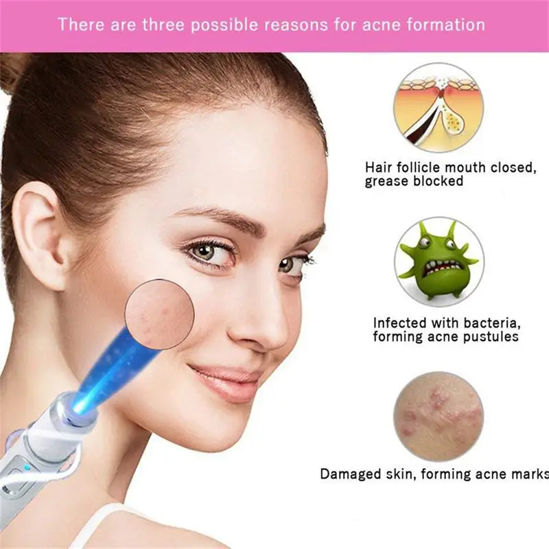 Blue Light Therapy Laser Pen Varicose Veins Treatment Soft Scar Wrinkle Removal Acne Treatment