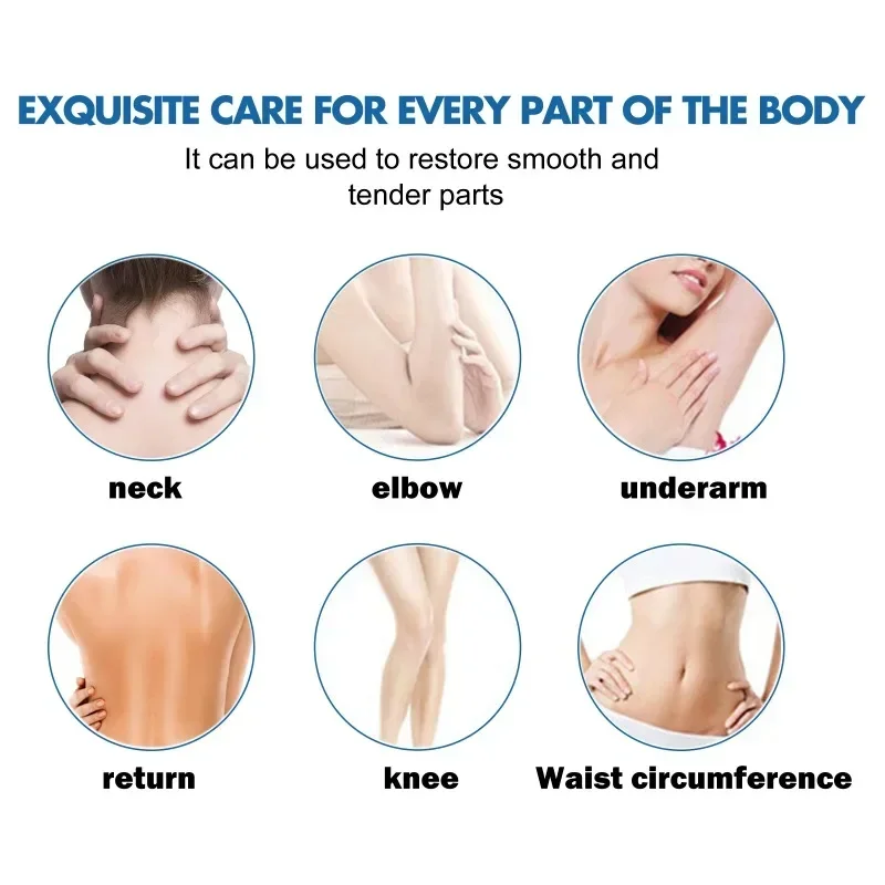 Skin whitening cream armpit Knee Neck removal dark Spots Melanin Bleaching Underarm Inner Thigh brighten moisturizing body care