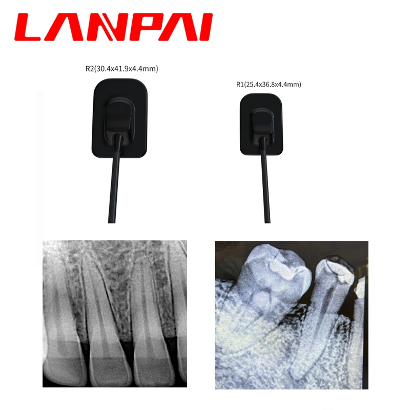 Lanpai Dental Radiovisograph Sensor Rx Digital portable x-ray Sensor With 13 Language Rvg Dentistry