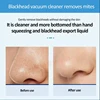 Nose Blackhead Peeling Solution Serum Facial Cleaning Liquid Scrub Special Solution Skin Deep Cleaning For Small Bubble 2