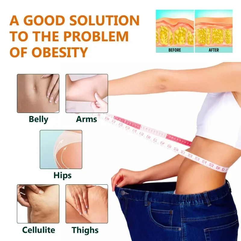 Slimming Essence Oil Fat Burning Belly Loss Fat Lose Weight Slim Down tighten abdominal thigh Weight Lose Schap Essential Oils | slimming patch,slimming cream gel