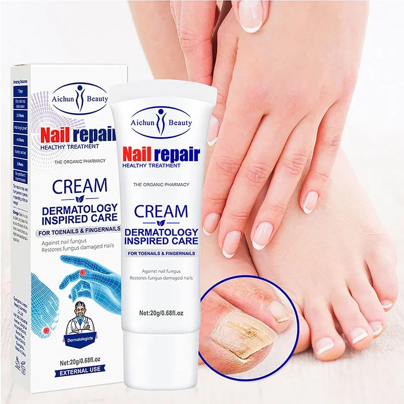 

20g Nail Repair Cream Cuticle Cream Smooth Hydrated Strong Nails Nail Care and Repair Cream Helps with Lime Nails