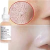Remove Large Pores Serum Lactic Acid Facial Pore Shrinking Repairing Products Pore Minimizing Firming Smooth Korean Skin Care 1