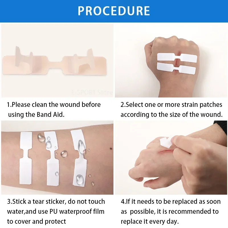 Stitch-Free Adhesive Bandages 6