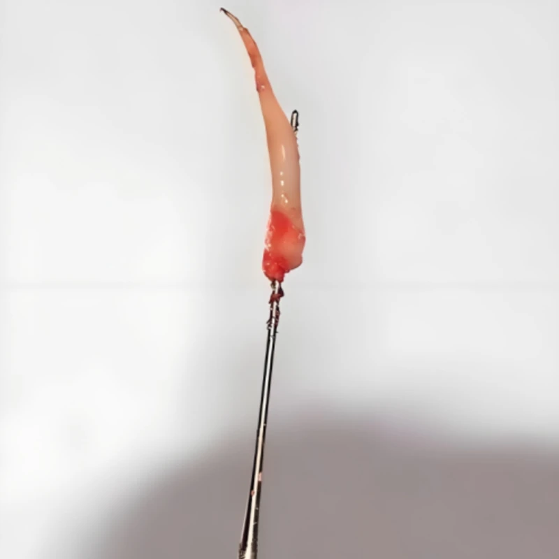 手根・足根針 61wnSl-vpJS._UF894,1000_QL80_.jpg