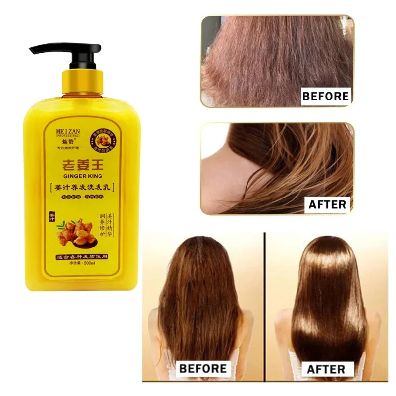 

Ginger Shampoo for Hair Growth,Anti-Hair Loss Hair Soft and Smooth,Anti-dandruff,Nourishing,Oil Control,Improve Head Itch Care