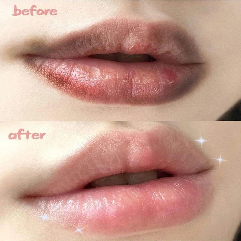 Fast Lightening Pink Lip Bleaching For Dark Lips Remove Melanin Lip Balm Sexy Rose Magic Lip Oil Whitening Moisturizing Makeup