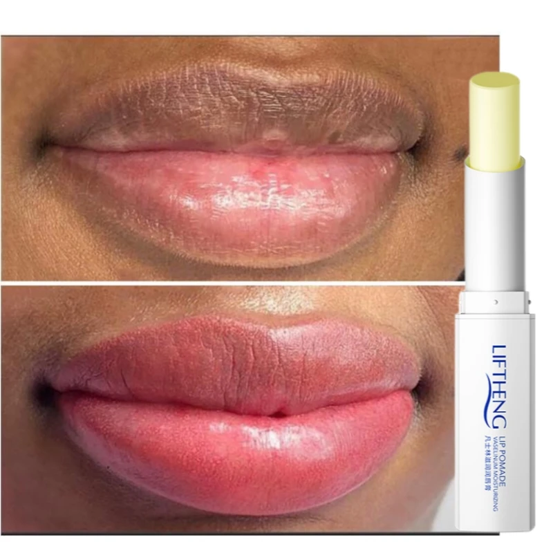 

Magic Lips Balm Gloss Anti-Cracking Permanently Remove Dark Black Lips Turn Pink Moisturizing Bleaching Nourish Makeup Care Gel