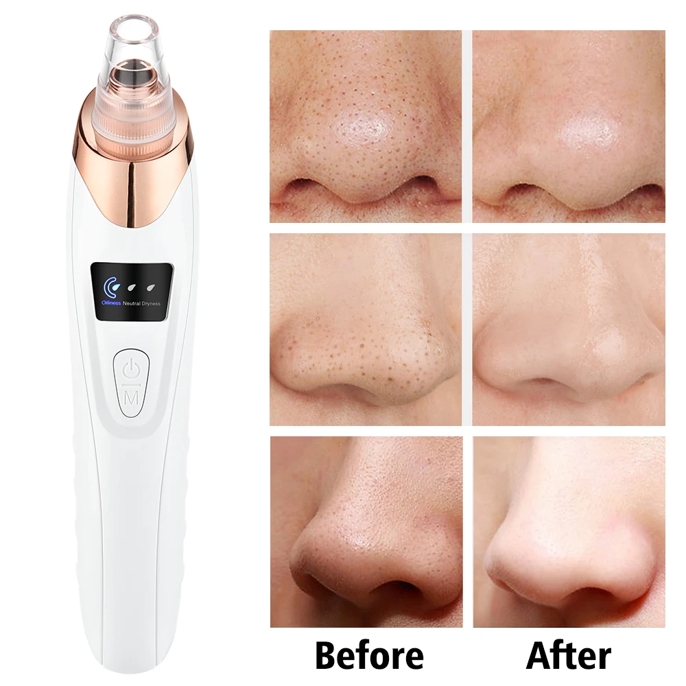 Electric Vacuum Suction Blackhead Remover Facial Pore Cleaner Comedone Spot Acne Pimple Blackhead Extractor USB Rechargeable 5