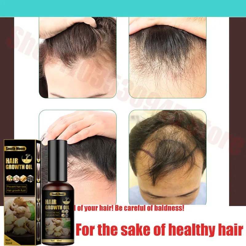 

Жидкость против выпадения волос и роста волос для роста волос, густых волос и фиксации волос, Травяной Растительный Экстракт, эссенция для волос