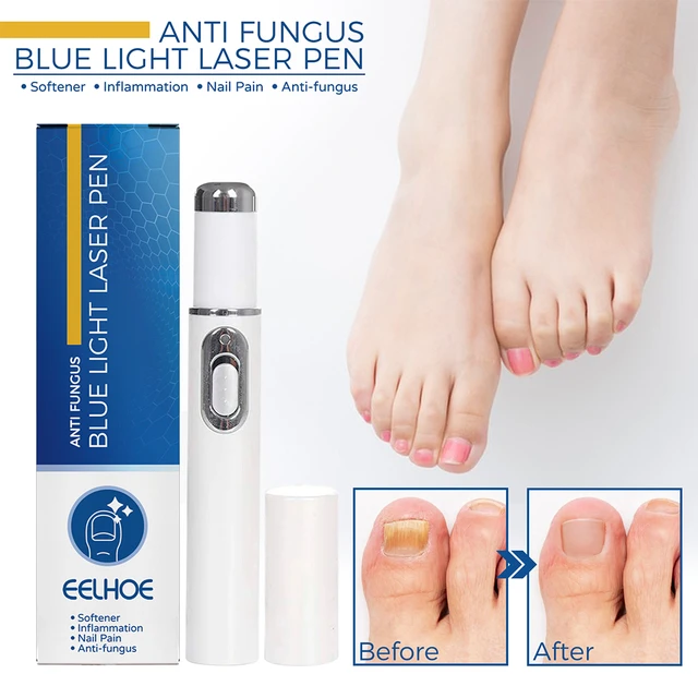 Anti-fungal Nail Treatment Kit Laser Pen Finger Toe Fungus Nail Care Liquid  Kit~ | eBay
