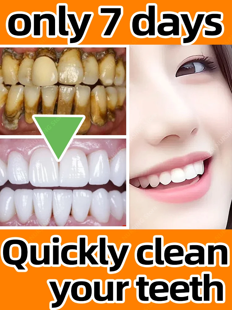 

Зубная паста для отбеливания зубов