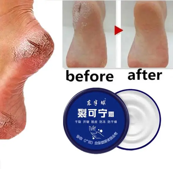 Herbal Anti Crack Foot Cream Oil Anti-Drying Crack Feet Cream Heel Cracked Repair Cream Removal Bad Skin Hand Feet Care Mask 85g