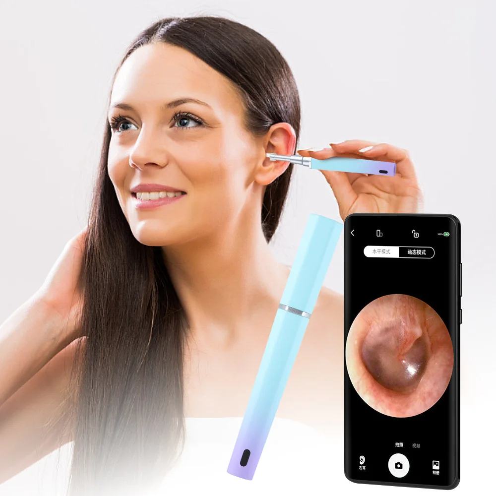 VITCOCO 5.5mm Wireless Smart Visual Ear Cleaner Otoscope Ear Cleaner