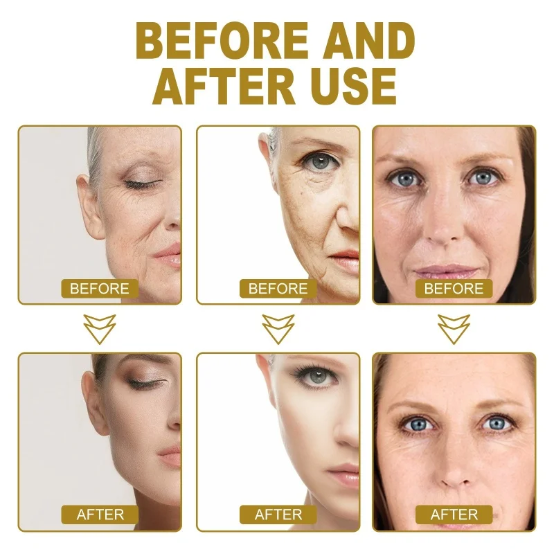 Gold Ginseng Face Essence Polypeptide Fading Fine Lines Anti Wrinkles Be-Tightening Brightening Moisturiz Facial Serum Skin Care 6