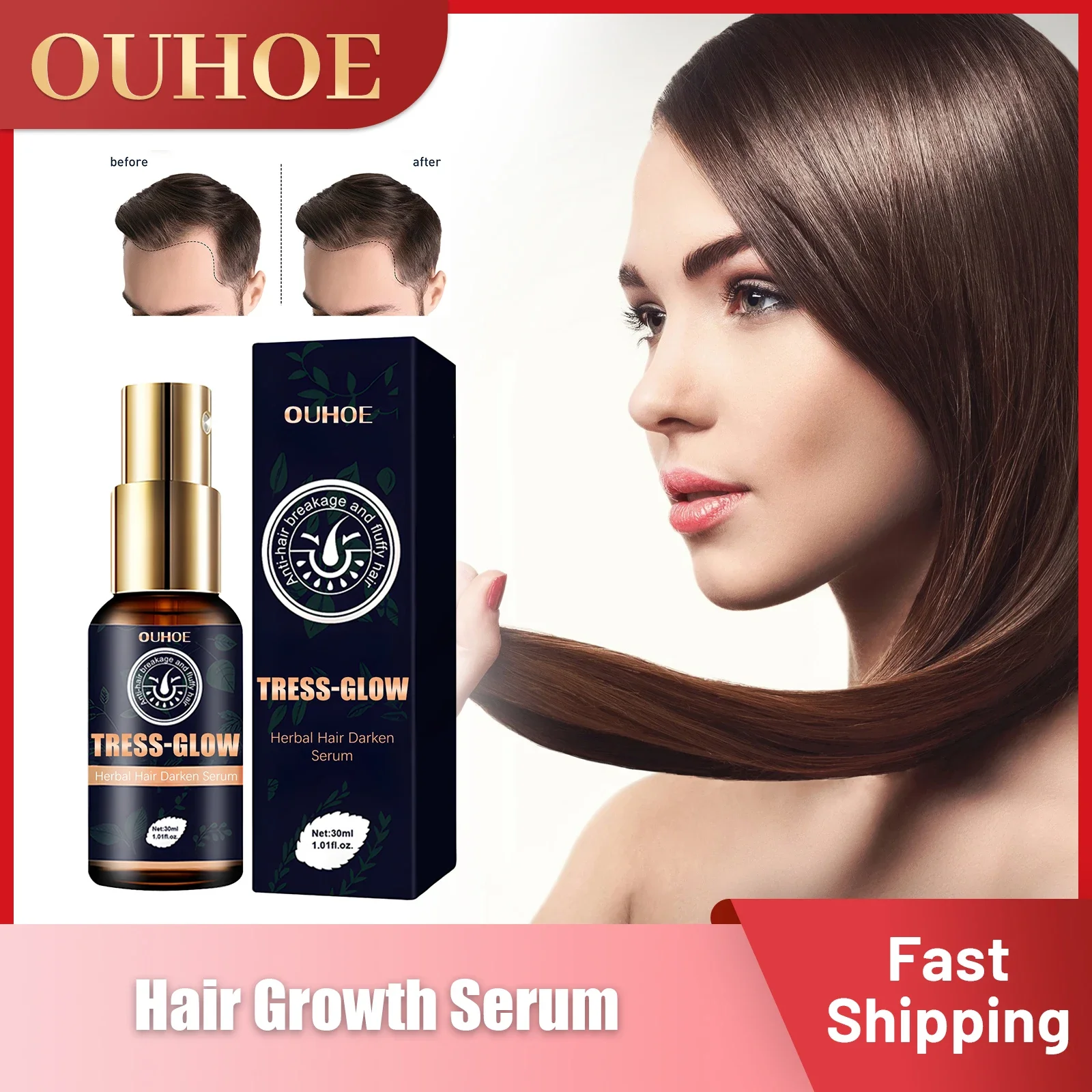 Hair Growth Serum Anti Hair Loss Thicken Hydrating Scalp Treatment Beard Hair Follicles Nourishing Repair Hair Root Ginger Care