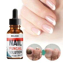 

Nail Fungus Treatment for Fingernails and Toenails Repair Solution for Cracked Discolored Fungus Nails from Toenail Fungus