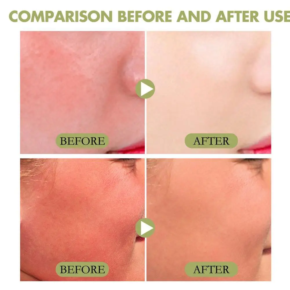 ماتي الشمس عصا منعش النفط السيطرة الصلبة واقية من...