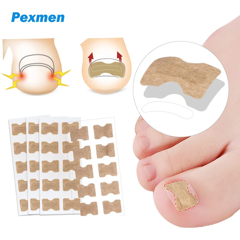 Pexmen 10/20/50/100Pcs Ingrown Toenail Correction Stickers Toenail Corrector Patch Keep Nails Healthy & Relieve Pain cat water fountain filters 16pcs 4 filter keep pets healthy