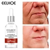 B3 Peptide Remove Wrinkle Serum Firming Lifting Anti-Aging Fade Fine Lines Face Essence For Treatment Facial lines Forehead Car 1