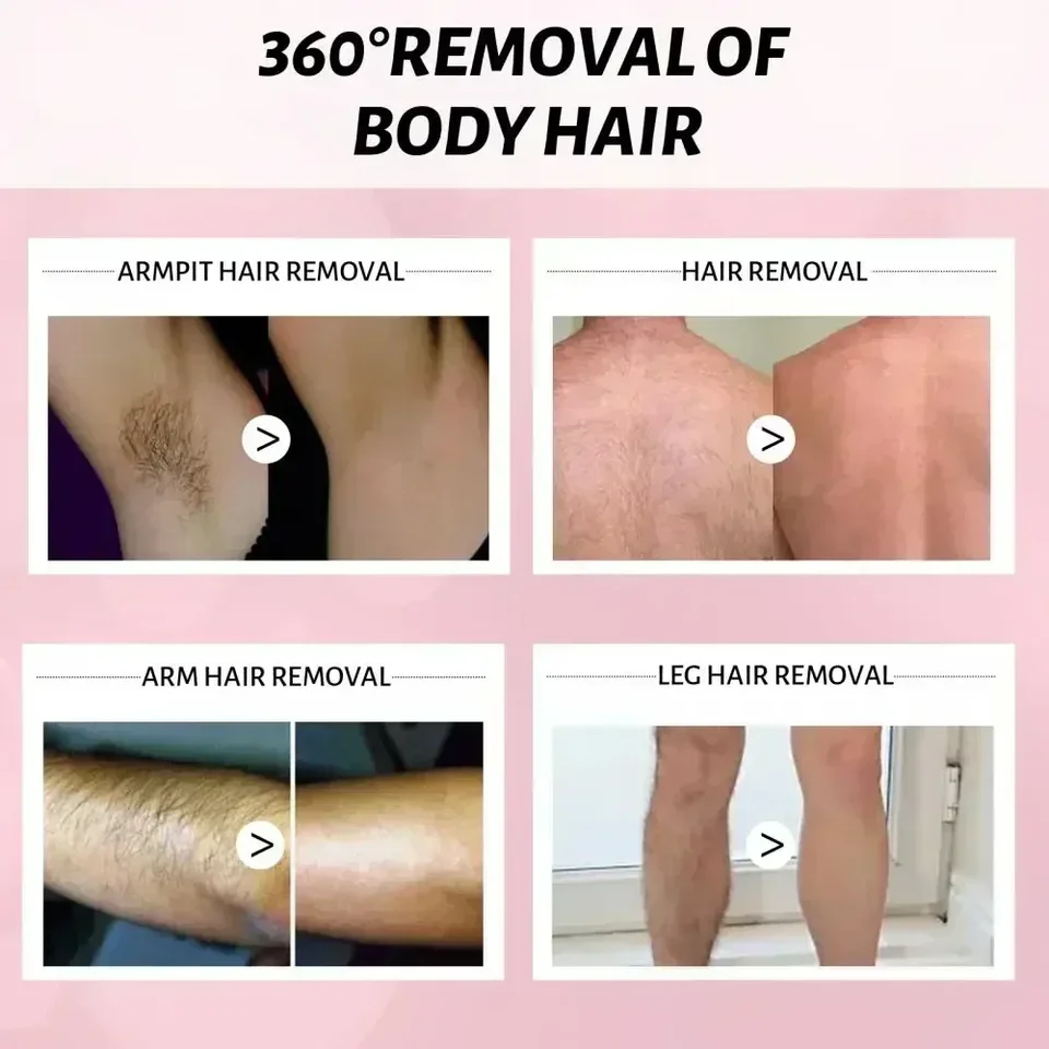 Dauerhaftes Haarentfernungsspray löst Haare sofort auf. Müheloses Aufsprühen. Sanft zur Haut. Schmerzfrei. Lang anhaltende Ergebnisse._voghion.com