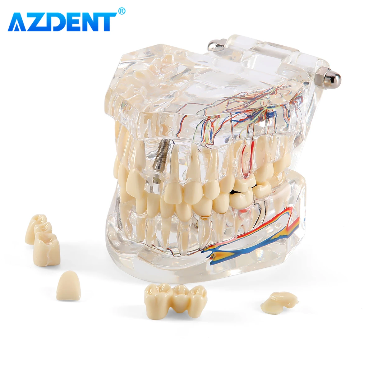 

Зубной имплантат AZDENT, патологическая модель, обучающий материал, ремонт зубов и нейролов, исследование, коммуникация, стоматологические лабораторные инструменты