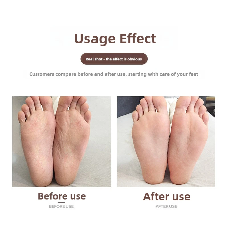 pcs Hard Skin Remover Nano Glass Foot File Foot Callus Remover