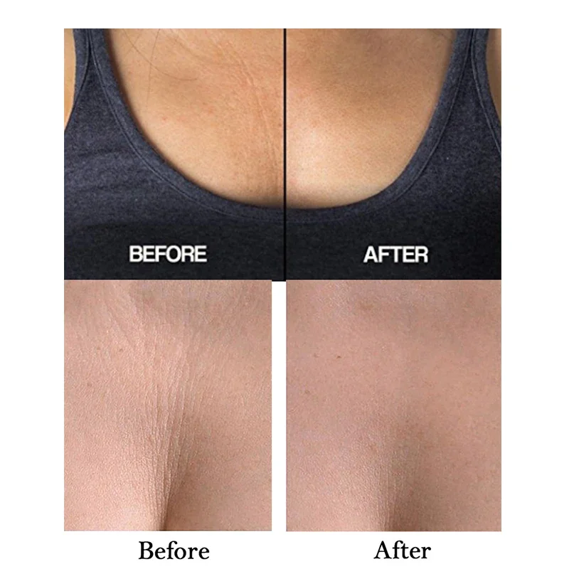 New Anti-wrinkle Chest Pads Reusable Chest Lift Patch Self-adhesive Chest Neck Pad Silicone Anti-Aging Wrinkle Remover Pad