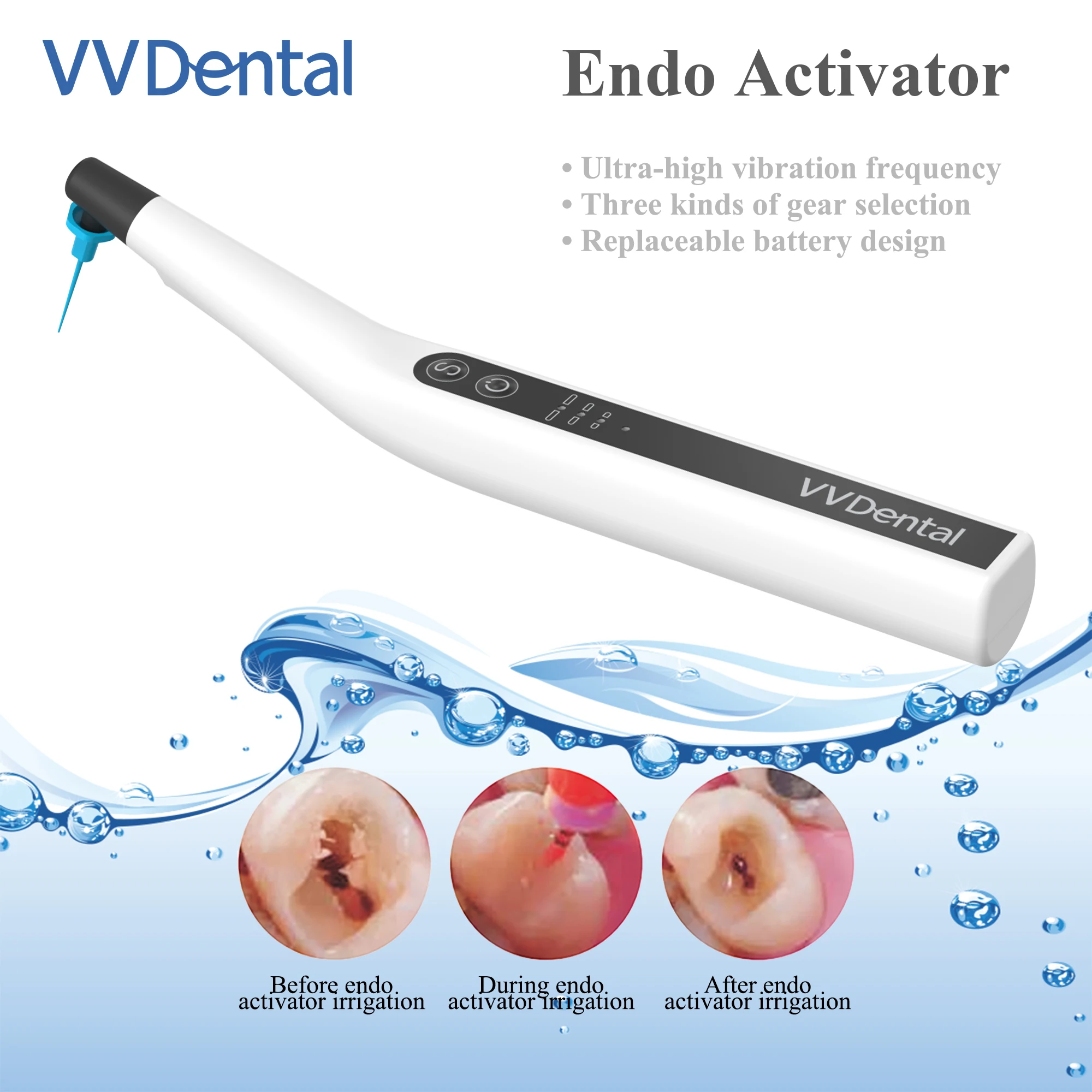 Electric Motor Dental Endoactivator With 60 Tips Sonic Irrigator With LED Light for Root Canal Endodontic Activator Motor VVDental Endomotor