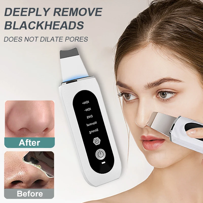 Ultrasonic Pele Deep Scrubber Facial Peeling removedor cravo limpeza