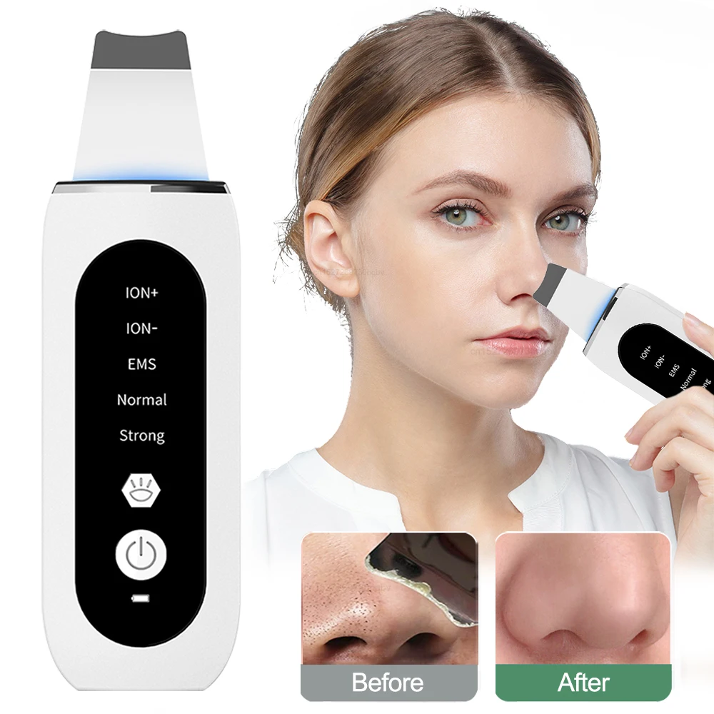 Ultrasonic Face Scrubber Black Dots Blackhead Remover Facial Peeling Machine With blackhead remover facial cleaner facial scrubber