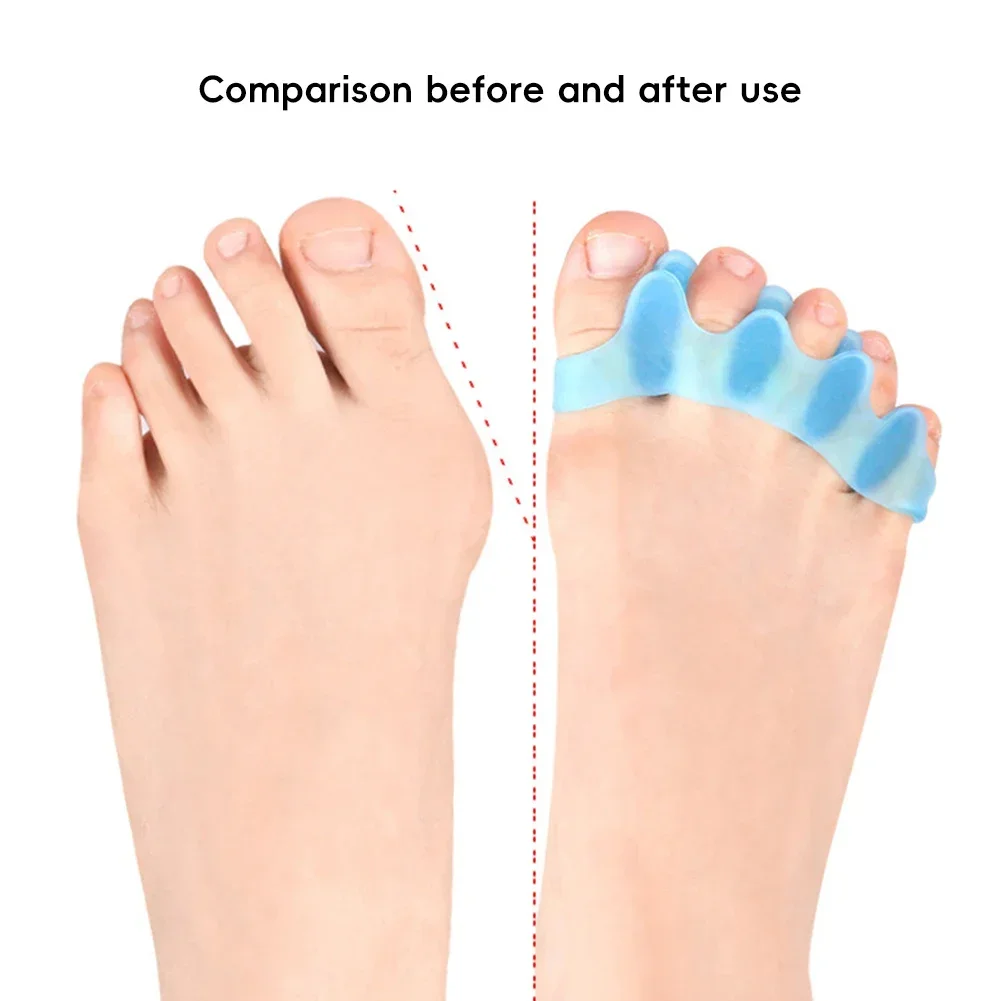 Lot de 2 séparateurs d'oignons en silicone souple, outil de soin des pieds_voghion.com