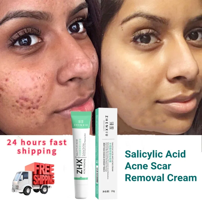 

30ml Salicylic Acid Acne Removal Cream Shrink Pores Refining Cream Blackhead Remover Anti-aging Oil Skin Care Korean Products