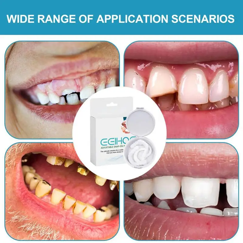1 Pair Resin Teeth Veneers Repair Kit To Cover Imperfect Teeth Adjustable Snap On Dentures For Temporary Teeth Confident Smile