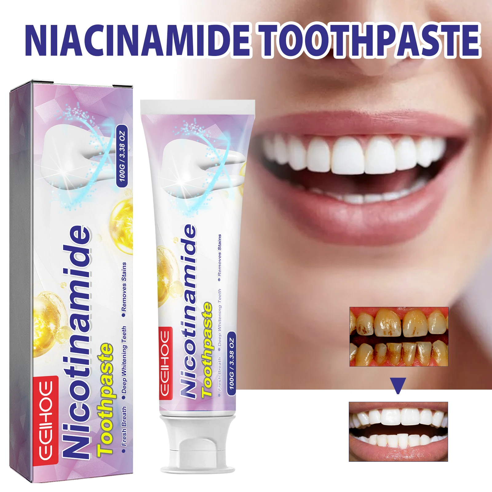 Eelhoe Nicotinamide Toothpaste Removes Tooth Stains Tartar Dazzler Toothpaste Freshens Breath Clean Mouth Brightening Toothpaste