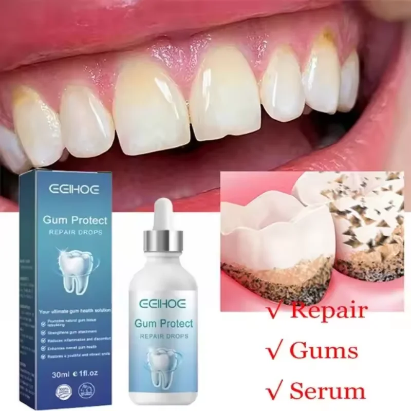 Gum Repair Drops Rapid Repair Gums Serum Effectively Relieve Tooth Allergy Dental Caries Tooth Cleaning Toothpaste Relieve Damage