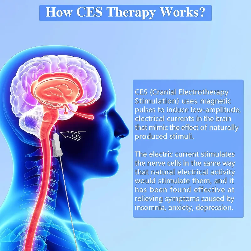 CES Cranial Electrotherapy Stimulation Device for Insomnia Sleep Anxiety and Depression Relief Treatment