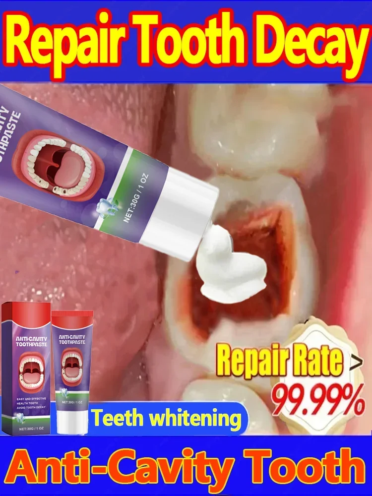 Anti Caries Repairing Cavities Tooth Decay Repair