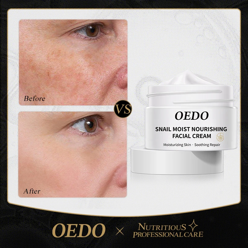 

OEDO Snail Face Cream Anti-Aging Wrinkle Reduction Fine Line Reduction Moisturizing Whitening Freckle Removal Collagen Face Care