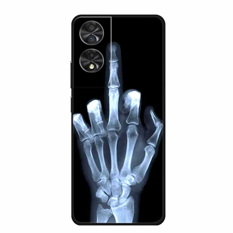 Animal Cartoon TPU Soft Silicone Phone Case Cover with Wolf Design