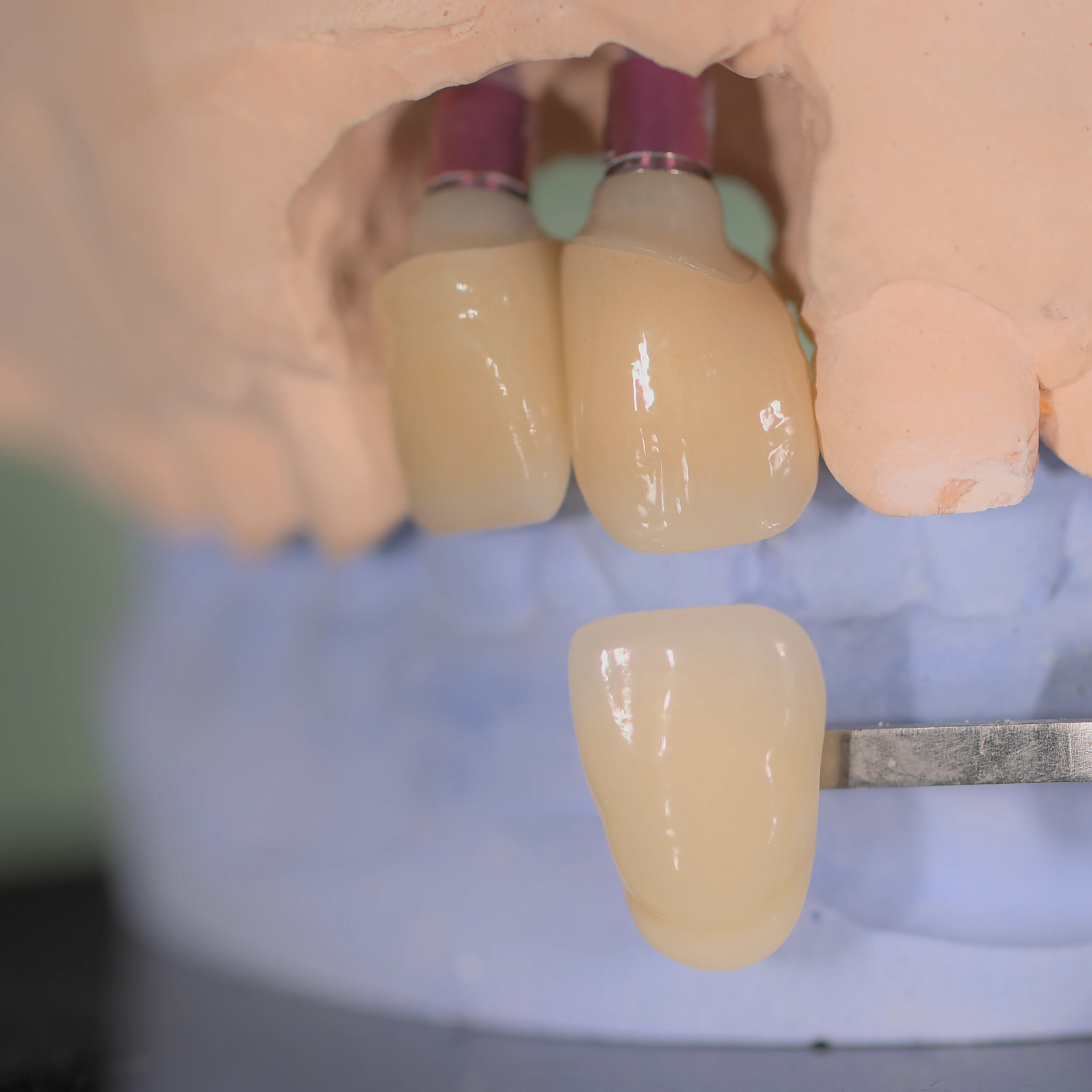 Dental Bridge Zirconia 3DPro Multilayer Denture repair materials Super Translucency 98mm System