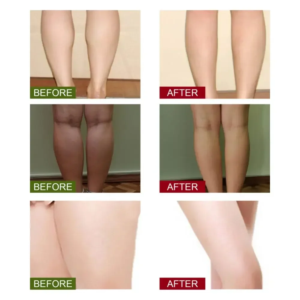 Foot Detox Patches Wormwood Pads Stress Relief Sleeping