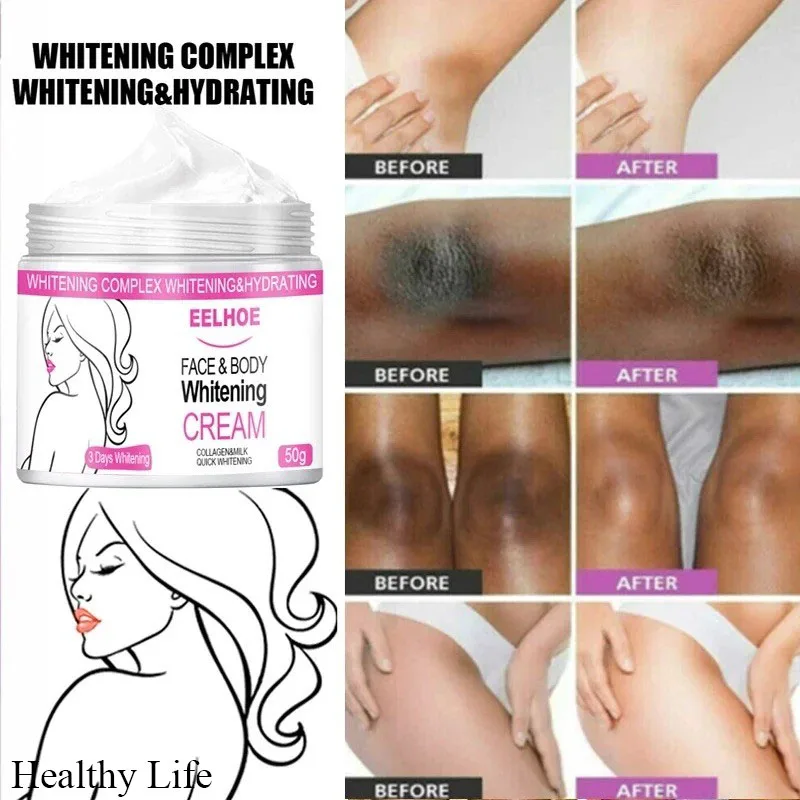 Bikini Private Parts Brighten Cream Women Intimate Area Whitening Cream Underarm Knee Body Bleaching Emulsion Whiten Skin Care
