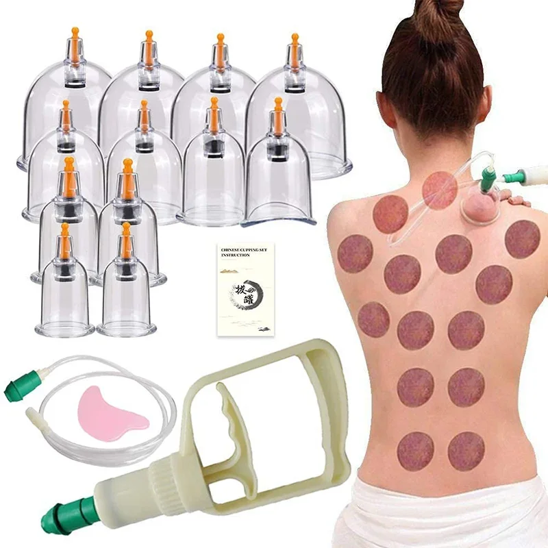 vacuum cupping accessories including tube and components