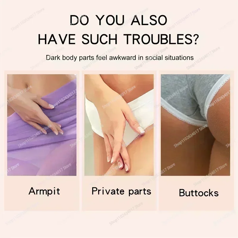 HOT ~ Crema sbiancante Parti intime Ascelle Siero sbiancante Sbiancare il culo Ginocchio Illumina l'interno della coscia Parti intime Scuro Rimuovi Mela 3