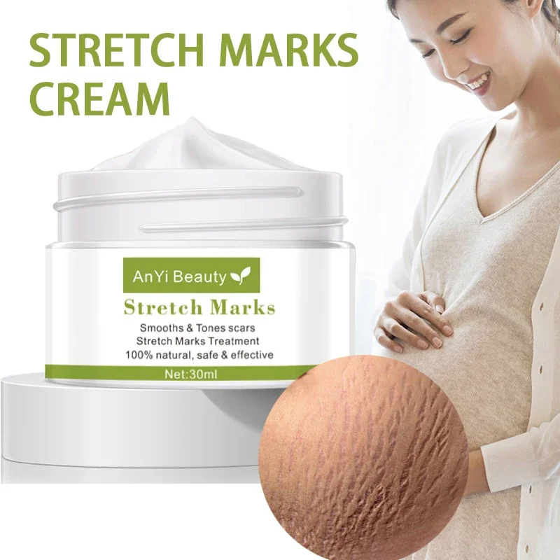 

Pregnancy Stretch Mark Repair Cream Maternity Obesity Skin Treatment Body Postpartum Stretch Scar Marks Remover Smooth Skin Care